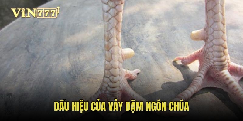Dấu hiệu của vảy dặm ngón chúa